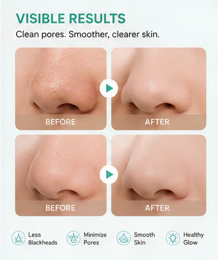 Mini Facial Blackhead Remover